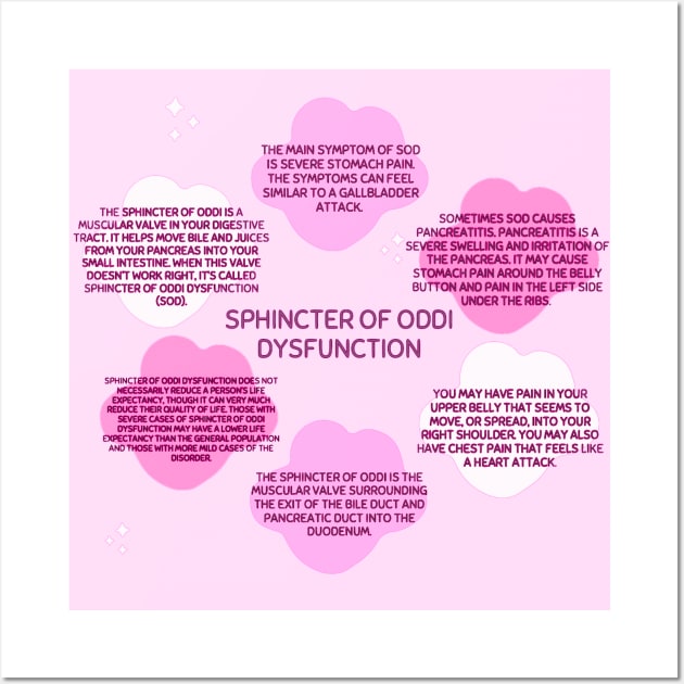 Sphincter Of Oddi Dysfunction Wall Art by ROLLIE MC SCROLLIE